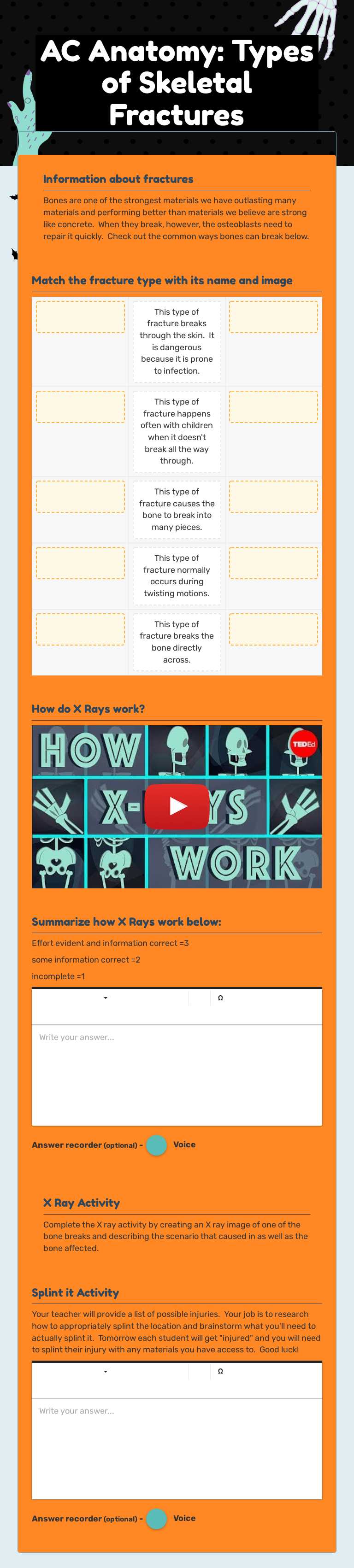 AC Anatomy:  Types of Skeletal Fractures worksheet preview